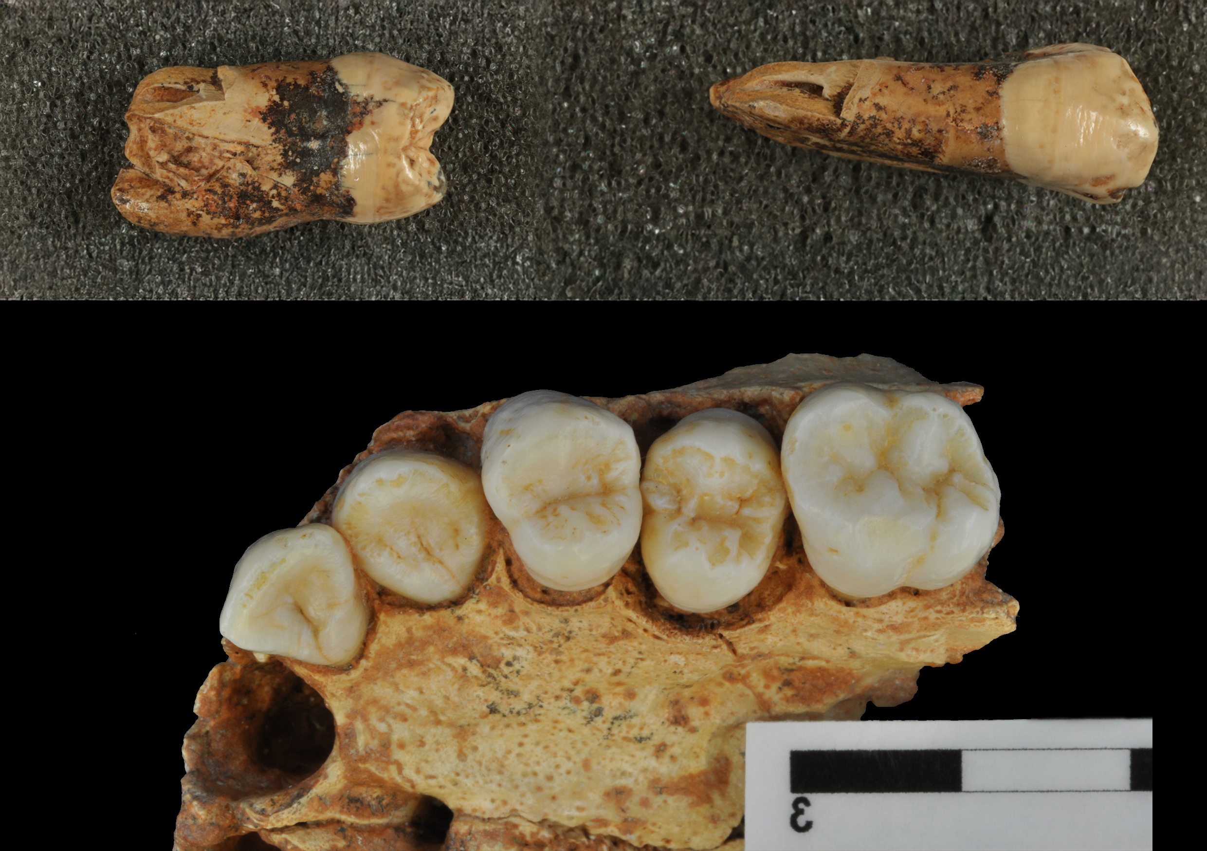 Premolares y maxilar de Homo antecessor/Laura Martín et al