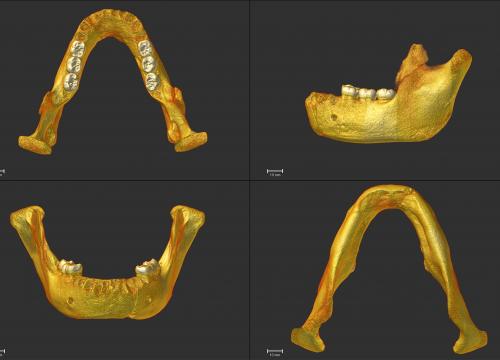 Reconstrucción virtual de la mandíbula de Montmaurin-La Niche/M. Martínez de Pinillos 