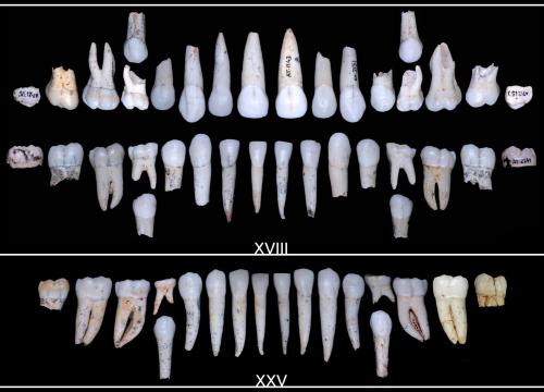 Teeth from individuals XVIII (top) and XXV (bottom) from Sima de los Huesos/Mario Modesto Mata