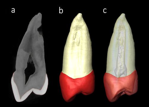 Premolar de Sima de los Huesos: a