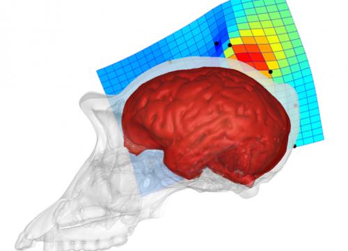 Primer estudio sobre la diferencia entre los lóbulos parietales de humanos y chimpancés