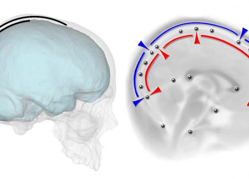 Nuevo estudio  sobre las relaciones espaciales entre cerebro y cráneo en los humanos modernos 