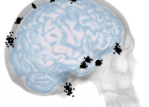 Nuevo estudio sobre la integración entre cráneo y cerebro