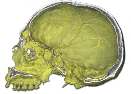 Un estudio analiza los rasgos craneovasculares y el parietal humano