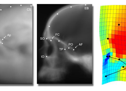 New study investigates a conflict between the development of the eyes and the cerebral cortex