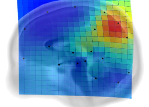 The precuneus, key in the brain evolution of our species