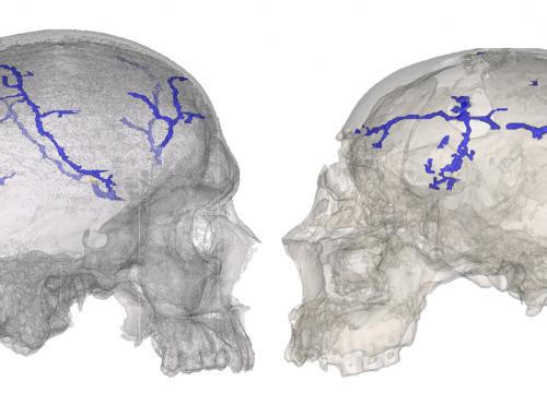 Nuevo procedimiento para estudiar el sistema vascular interno del cráneo