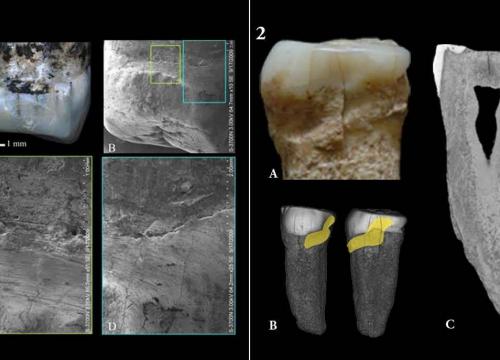 New evidence for tooth-picking behavior in Homo erectus