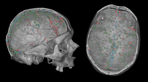 Gallareto-Sande et al AR2026-Bruner
