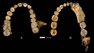 Dushan 1 dentition/Wei Liao