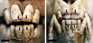 Defectos del esmalte dental de macaco japonés salvaje/Ian Towle