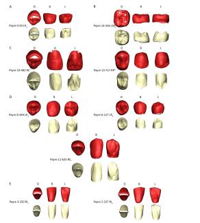 Human dental remains recovered from the Payre site (France) included in the study / Martín-Francés et al