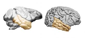 Brains and temporal lobes in mangabeys and chimpanzees/A. Pearson