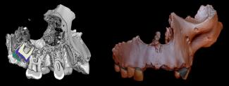 Micro-CT iImages of a fossil maxilla of 'Homo antecessor'/Laura Martín-Francés Micro-CT iImages of a fossil maxilla of 'Homo antecessor'/Laura Martín-Francés-Francés