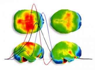 Simulaciones computadas permiten investigar la relación entre geometría cerebral y termorregulación