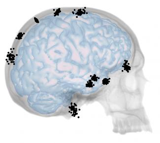 Nuevo estudio sobre la integración entre cráneo y cerebro