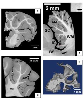 Nueva técnica para visualizar tejido cerebral
