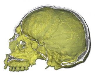 Un estudio analiza los rasgos craneovasculares y el parietal humano