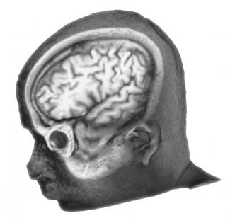 Nuevo estudio sobre ojos, órbitas oculares y áreas cerebrales