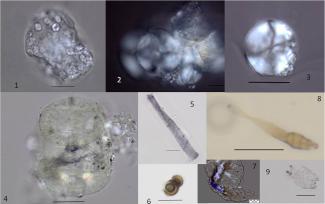 A study reveals plant-based diet of Europe’s oldest hominin