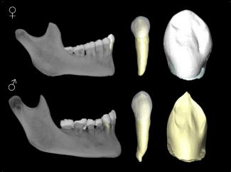 New forensic methodology allows the sex of human remains to be identified with a reliability of 92%