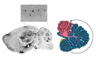 Un nuevo estudio relaciona el cerebelo con la enfermedad de Alzheimer