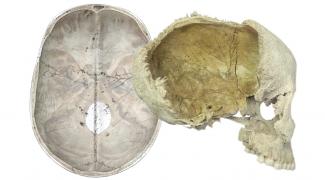 Review on craniovascular traits in anthropology and evolution