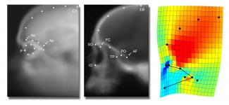 New study investigates a conflict between the development of the eyes and the cerebral cortex