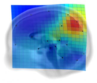 The precuneus, key in the brain evolution of our species