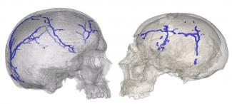 Nuevo procedimiento para estudiar el sistema vascular interno del cráneo