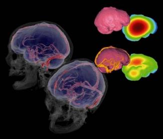 Científicos del CENIEH presentan un método pionero para conocer la fisiología cerebral de los fósiles